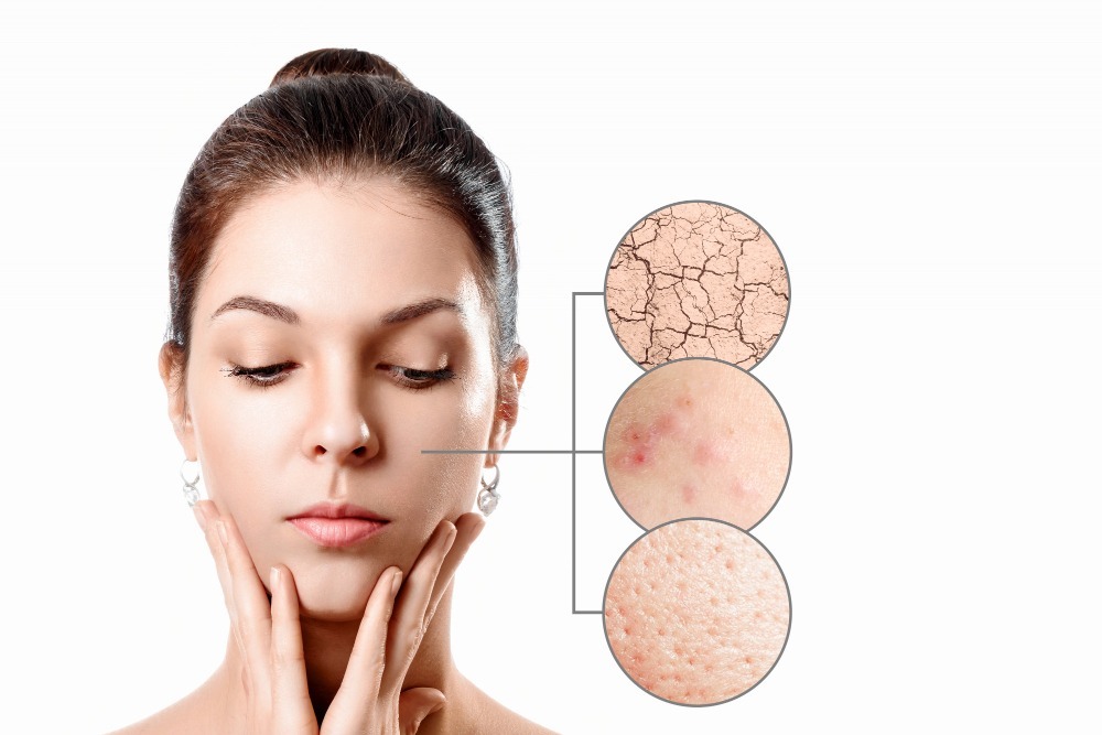 Bạn có thể xác định loại da bằng cách quan sát lượng dầu, độ ẩm và phản ứng của da sau khi rửa mặt.