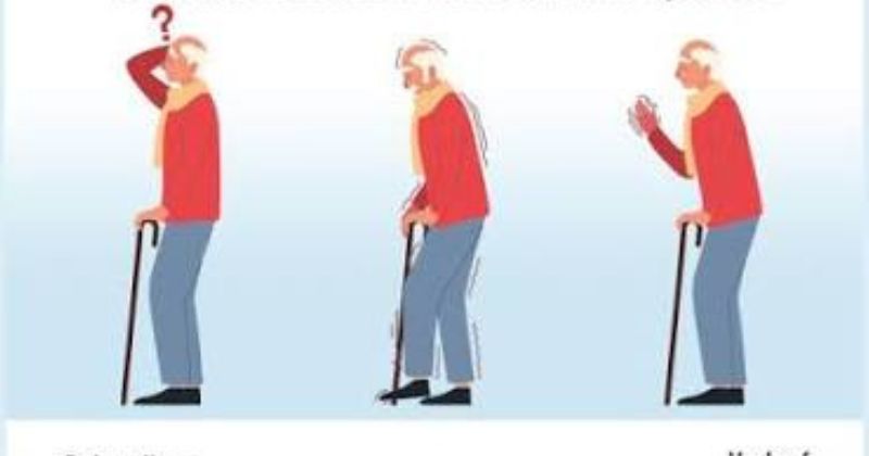 Các dấu hiệu nhận biết bệnh parkinson điển hình